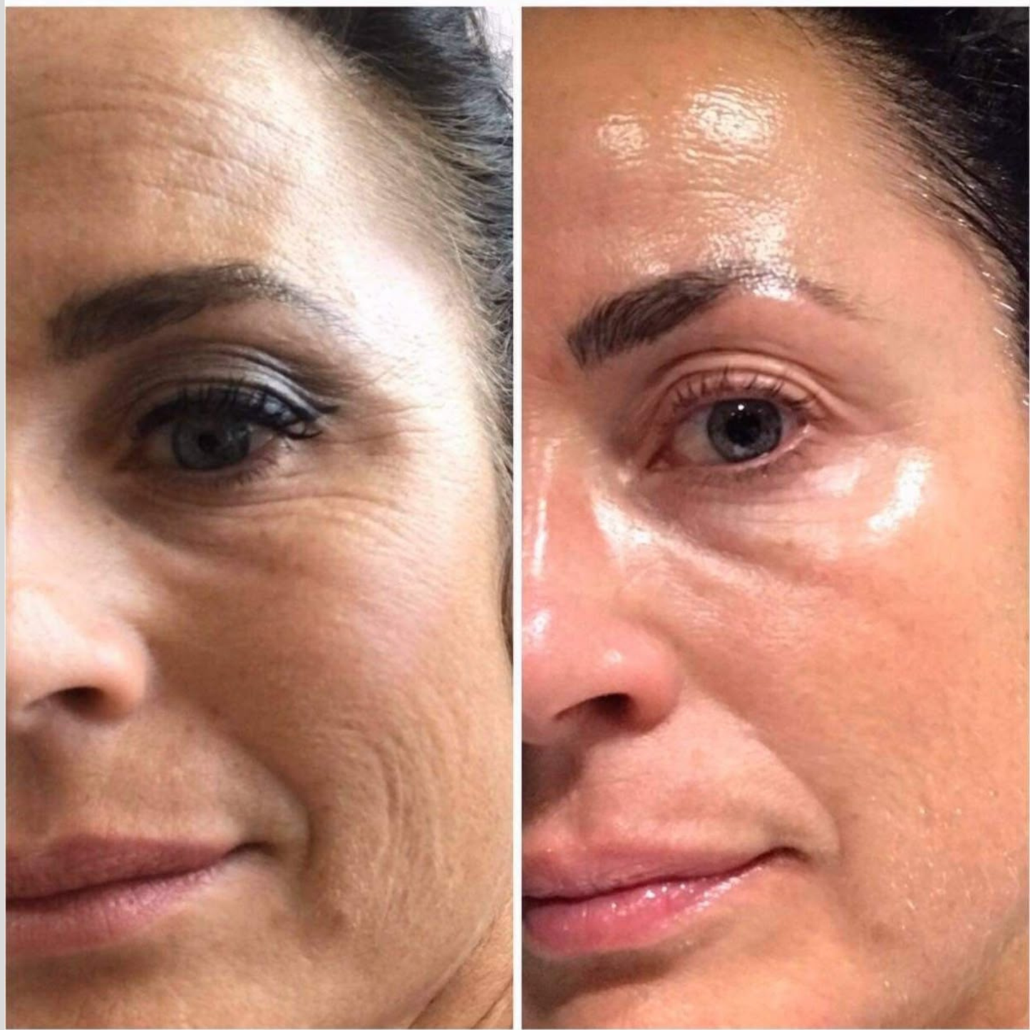 Vita A Retinal Shot Firming Serum